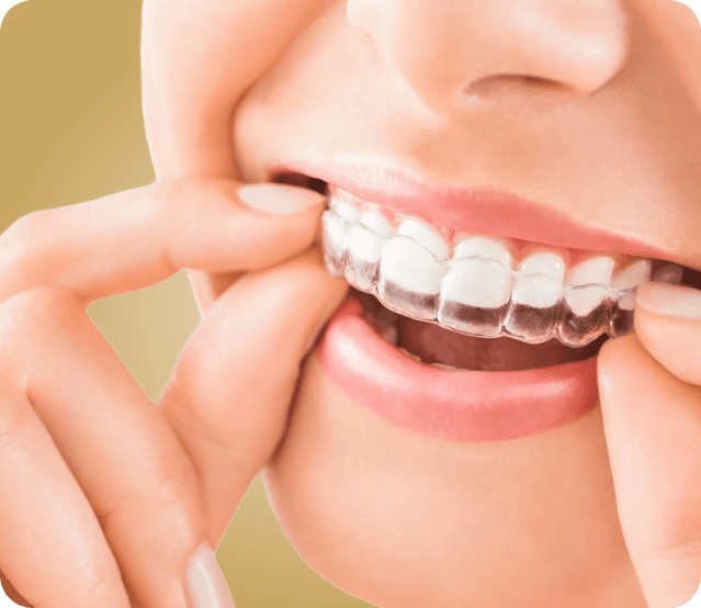 Amare Odontologia - Modelo